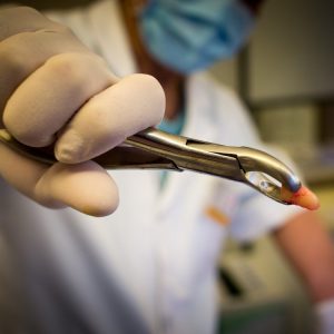 Odontólogo en Puente de Vallecas y Tetuán Madrid, dentista en Puente de Vallecas y Tetuán Madrid, clínica dental en Puente de Vallecas y Tetuán Madrid