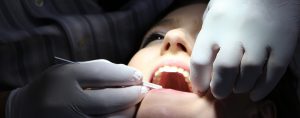 Odontólogo en Puente de Vallecas y Tetuán Madrid, dentista en Puente de Vallecas y Tetuán Madrid, clínica dental en Puente de Vallecas y Tetuán Madrid