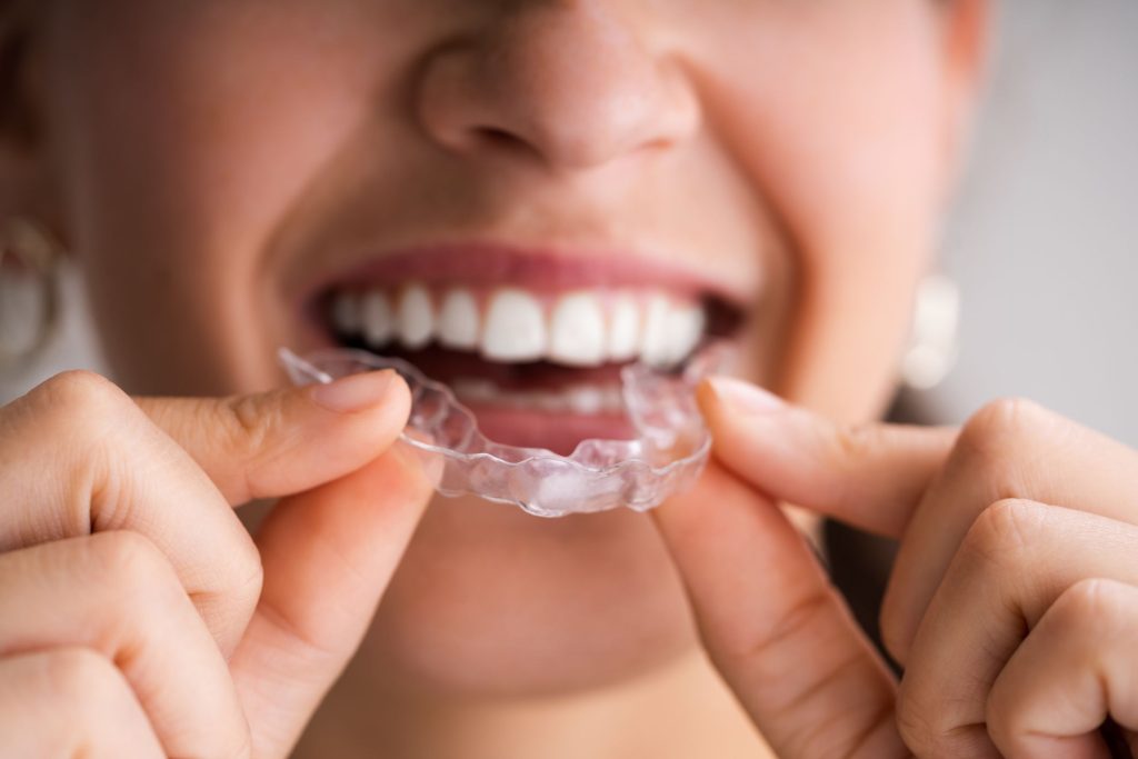 Odontólogo en Puente de Vallecas y Tetuán Madrid, dentista en Puente de Vallecas y Tetuán Madrid, clínica dental en Puente de Vallecas y Tetuán Madrid