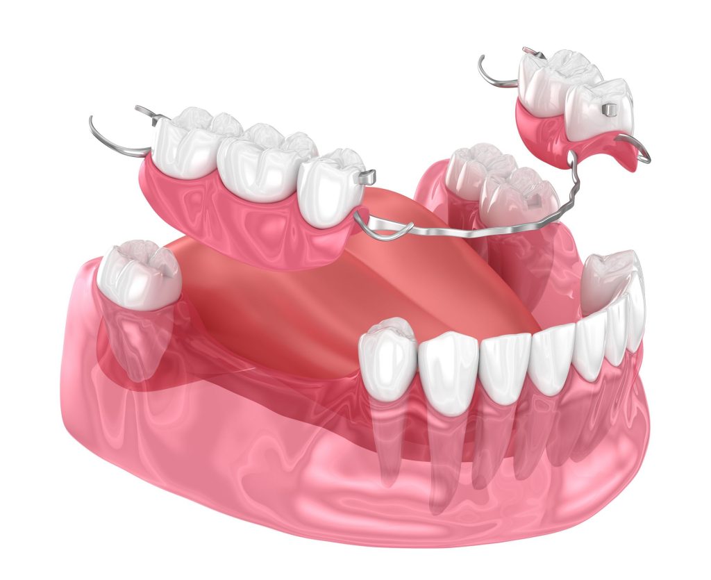 Odontólogo en Puente de Vallecas y Tetuán Madrid, dentista en Puente de Vallecas y Tetuán Madrid, clínica dental en Puente de Vallecas y Tetuán Madrid
