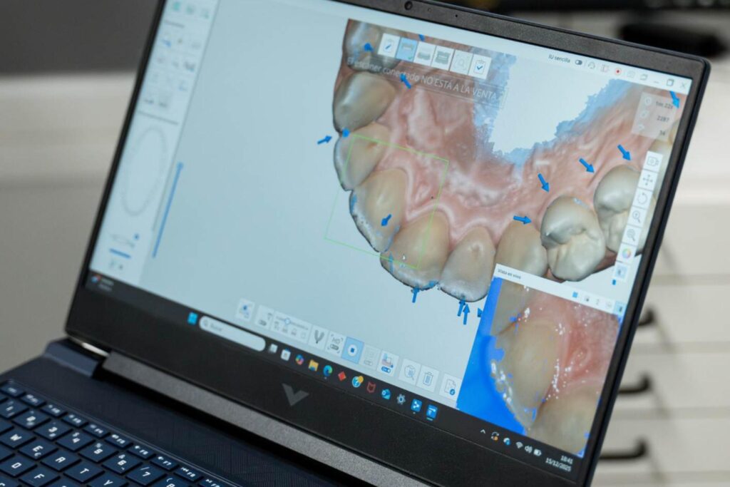 Odontólogo en Puente de Vallecas y Tetuán Madrid, dentista en Puente de Vallecas y Tetuán Madrid, clínica dental en Puente de Vallecas y Tetuán Madrid