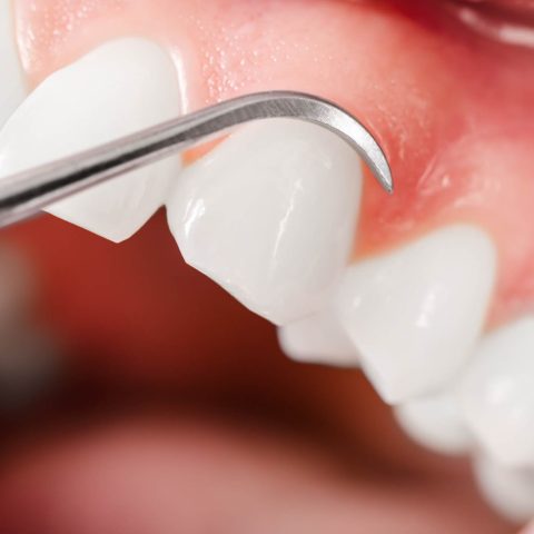 Odontólogo en Puente de Vallecas y Tetuán Madrid, dentista en Puente de Vallecas y Tetuán Madrid, clínica dental en Puente de Vallecas y Tetuán Madrid
